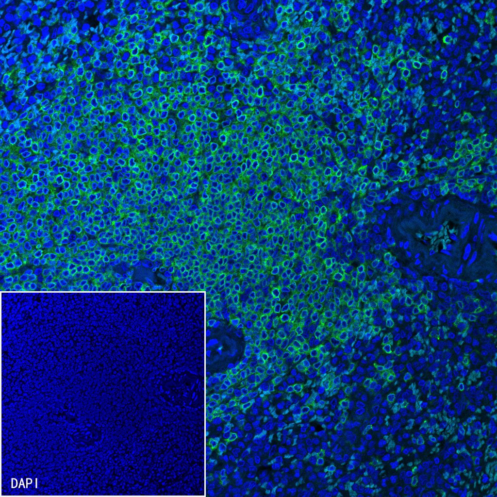 CD79a/MB-1 Recombinant Rabbit mAb (SDT-030-18)