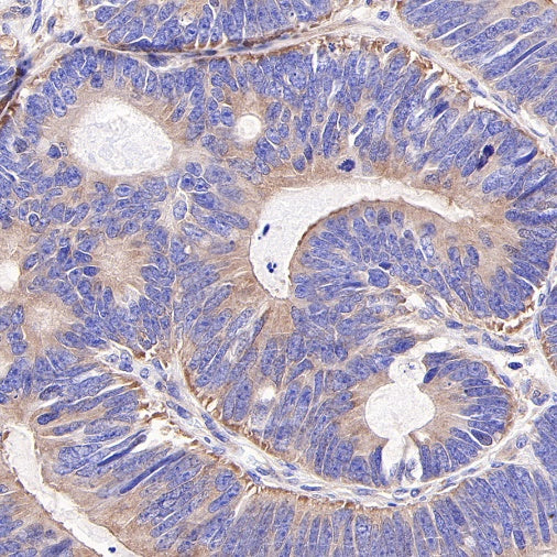 S-RMab®HDAC6 Recombinant Rabbit mAb (S-R338)