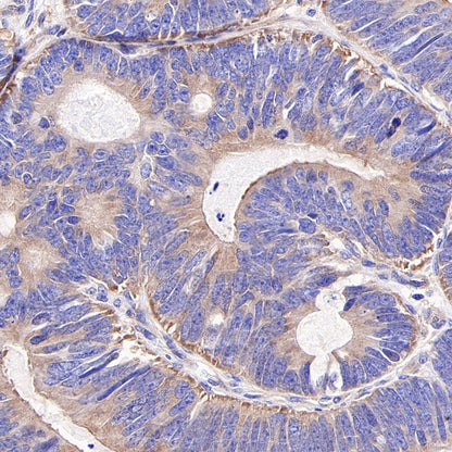 S-RMab®HDAC6 Recombinant Rabbit mAb (S-R338)