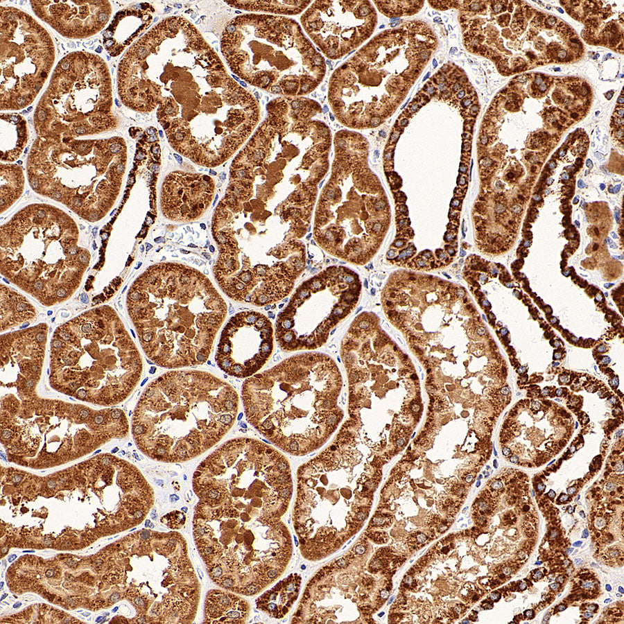 GOT2 Recombinant Rabbit mAb
