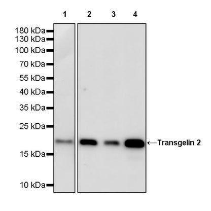 Transgelin 2 Recombinant Rabbit mAb (S-2809-73)