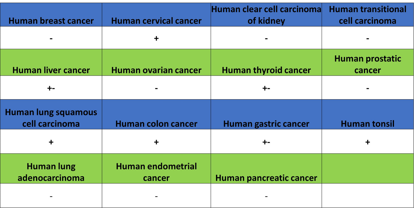FoxO1 Recombinant Rabbit mAb (S-5118)