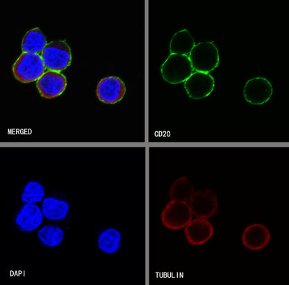S-RMab® CD20 Recombinant Rabbit mAb,PBS Only (SDT-R133)