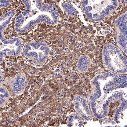 Vinculin Recombinant Mouse mAb (S-916-217)