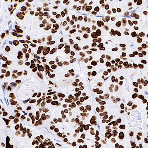 HMGA1 Recombinant Rabbit mAb (S-R332)