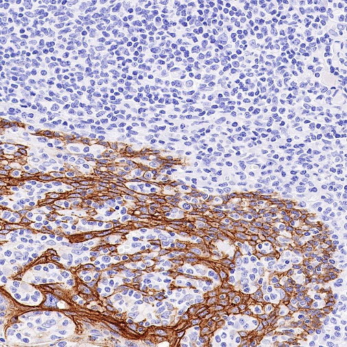 Claudin 1 Recombinant Rabbit mAb (SDT-1289-55)