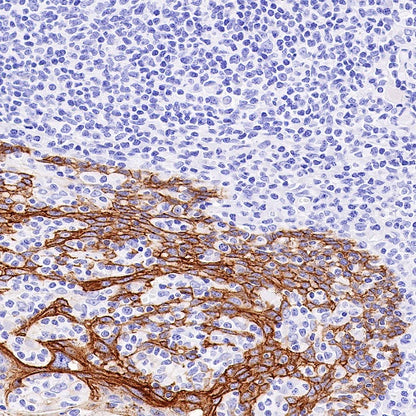 Claudin 1 Recombinant Rabbit mAb (SDT-1289-55)