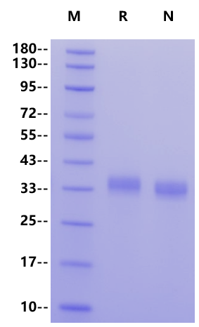 TROP2 His Tag Protein, Human