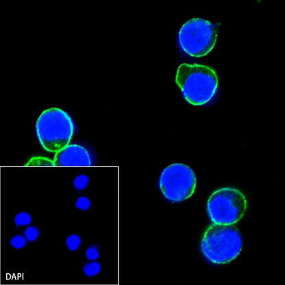 CD19 Recombinant Rabbit mAb (SDT-164-41)