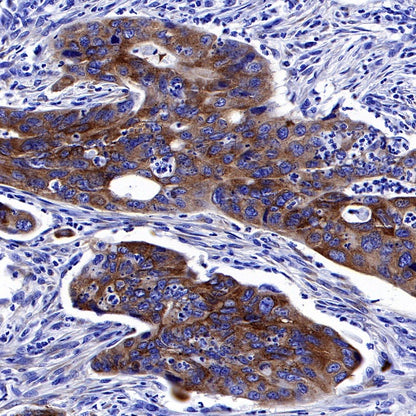 IMP-3 Recombinant Rabbit mAb (S-439-10)