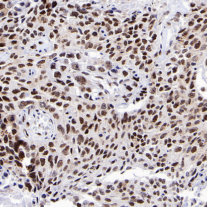 RFX5 Recombinant Rabbit mAb (S-3628-50)