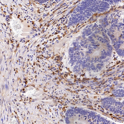 GBP5 Rabbit Polyclonal Antibody