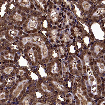 YB1 Recombinant Rabbit mAb (S-1748-144)