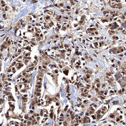 DCAF8 Recombinant Rabbit mAb (S-3483-11)