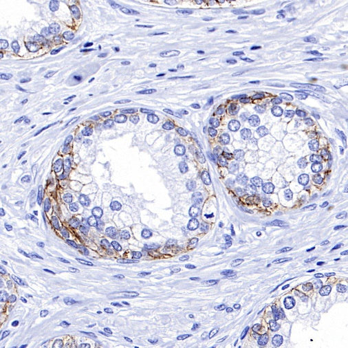 CD44v6 Recombinant Rabbit mAb (S-944-13)
