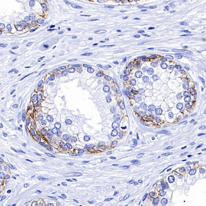 CD44v6 Recombinant Rabbit mAb (S-944-13)