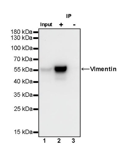 Vimentin Recombinant Rabbit mAb (SDT-029-120)