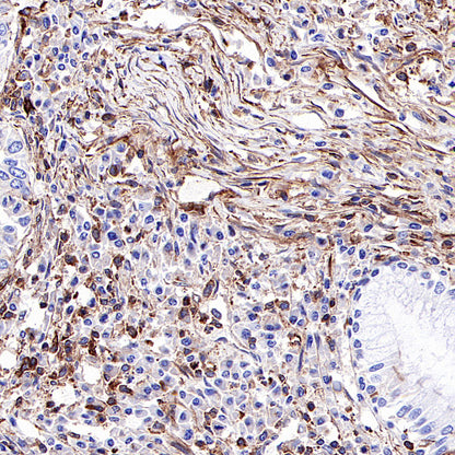 β-actin Recombinant Rabbit mAb (SDT-R156)