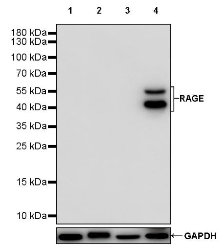RAGE Recombinant Rabbit mAb (S-1846-41)
