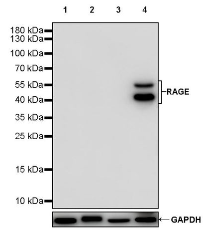 RAGE Recombinant Rabbit mAb (S-1846-41)