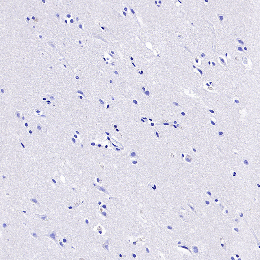 NNMT Recombinant Rabbit mAb (S-3470-58)