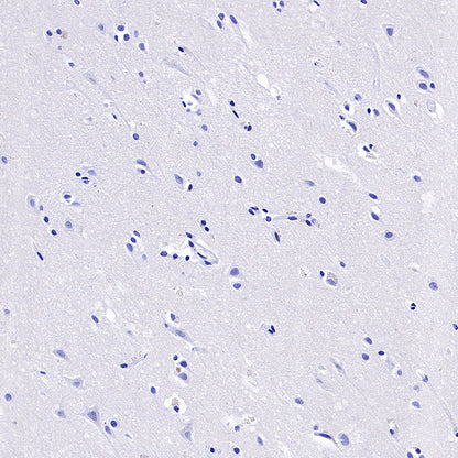 NNMT Recombinant Rabbit mAb (S-3470-58)