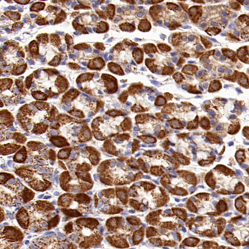 ATPB Rabbit Polyclonal Antibody