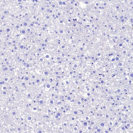 BACE1 Recombinant Rabbit mAb (S-2514-34)