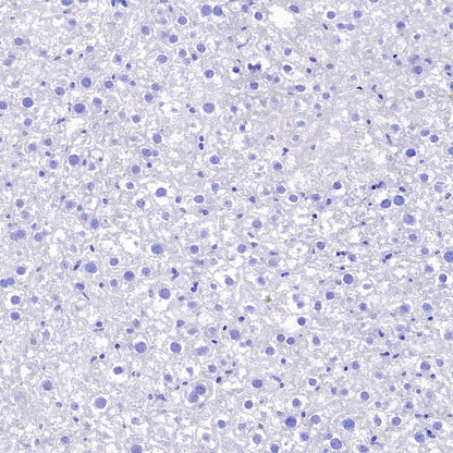 BACE1 Recombinant Rabbit mAb (S-2514-34)