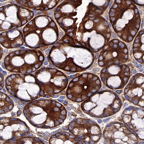 ST13 Recombinant Rabbit mAb (S-661-38)