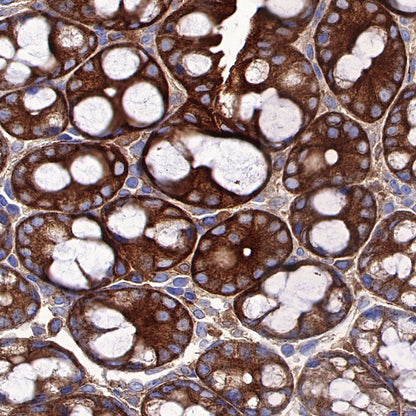 ST13 Recombinant Rabbit mAb (S-661-38)