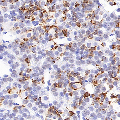 Prolactin/PRL Recombinant Rabbit mAb (S-235-215)