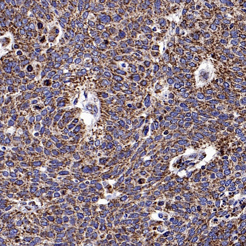 TOMM40 Rabbit Polyclonal Antibody