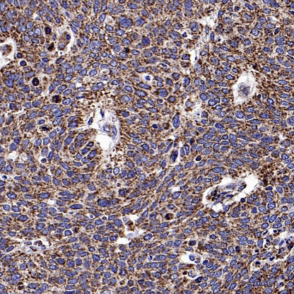TOMM40 Rabbit Polyclonal Antibody
