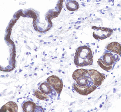 Keratin 14 Recombinant Rabbit mAb(SDT-023-1)