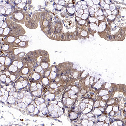 CHMP6/VPS20 Recombinant Rabbit mAb (S-1702-78)