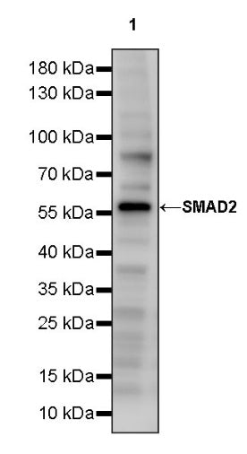 SMAD2 Rabbit Polyclonal Antibody