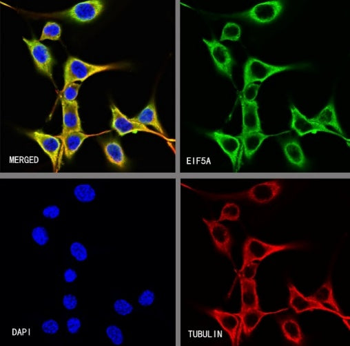 eIF5A Rabbit Polyclonal Antibody