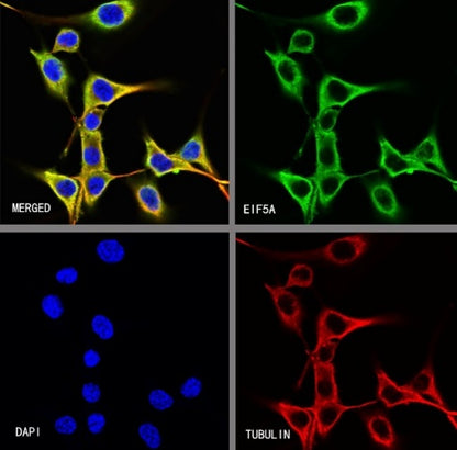 eIF5A Rabbit Polyclonal Antibody