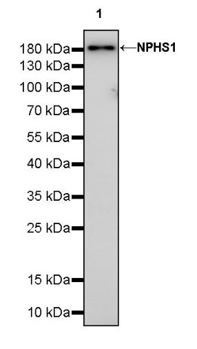 NPHS1 Recombinant Rabbit mAb (SDT-2148-63)