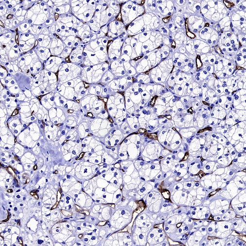Angiotensin Converting Enzyme 1 Recombinant Rabbit mAb (SDT-2662-122)