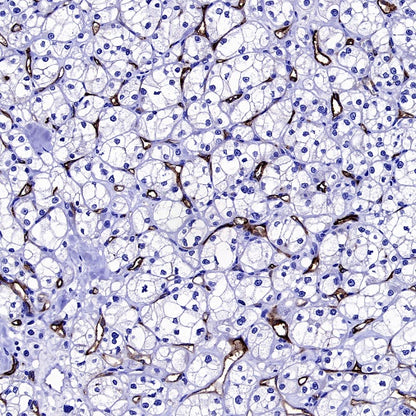 Angiotensin Converting Enzyme 1 Recombinant Rabbit mAb (SDT-2662-122)