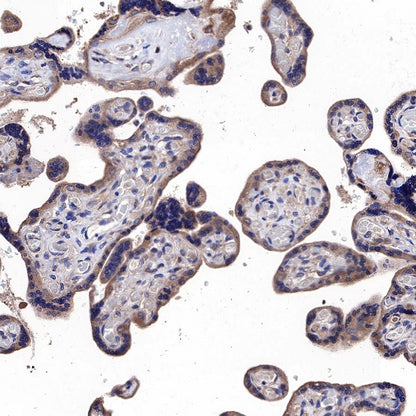 Atg5 Recombinant Rabbit mAb (SDT-456-9)