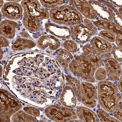 PLCG1 Recombinant Rabbit mAb (S-978-37)