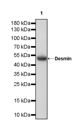 S-RMab® Desmin Recombinant Rabbit mAb (SDT-109-114)