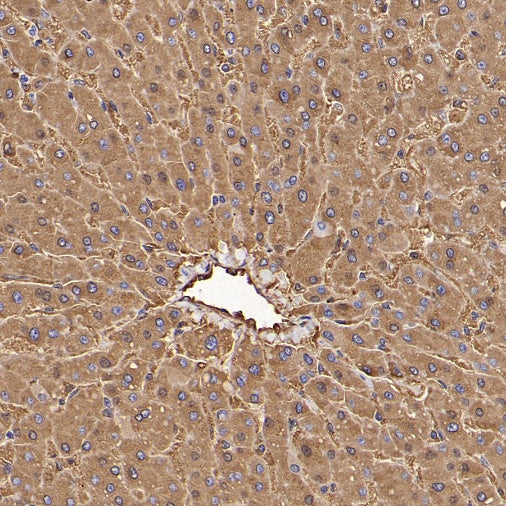 FTH1 Recombinant Rabbit mAb (S-1372-136)