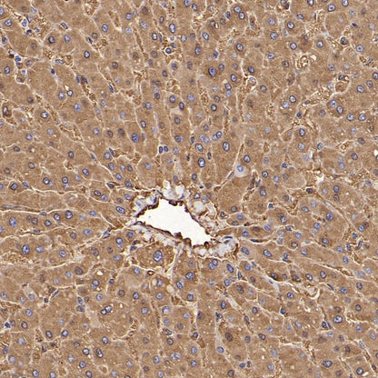 FTH1 Recombinant Rabbit mAb (S-1372-136)