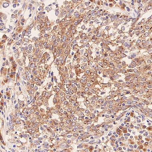 Glycogen Synthase Recombinant Rabbit mAb (S-2698-24)