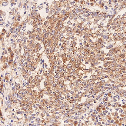 Glycogen Synthase Recombinant Rabbit mAb (S-2698-24)