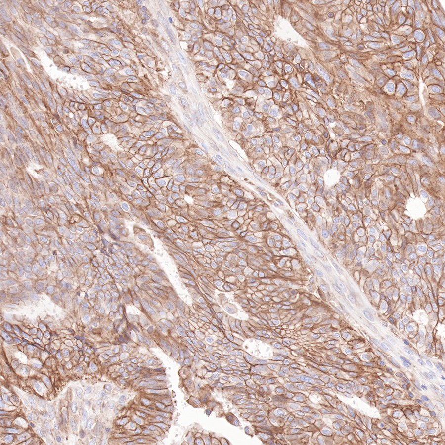 Beta 2 microglobulin Recombinant rabbit mAb (SDT-096-100)